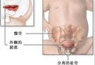 输尿管结构异常的症状有哪些